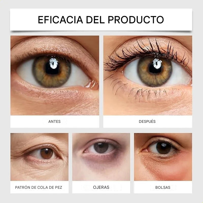EyeLift Pro ® – Elimina bolsas y ojeras en solo 5 minutos sin cirugía ni dolor