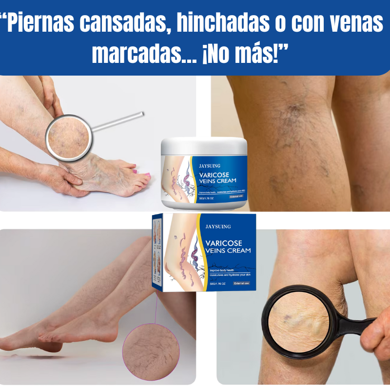 Crema Varicelax – Elimina las Várices y el Dolor en Solo 2 Semanas