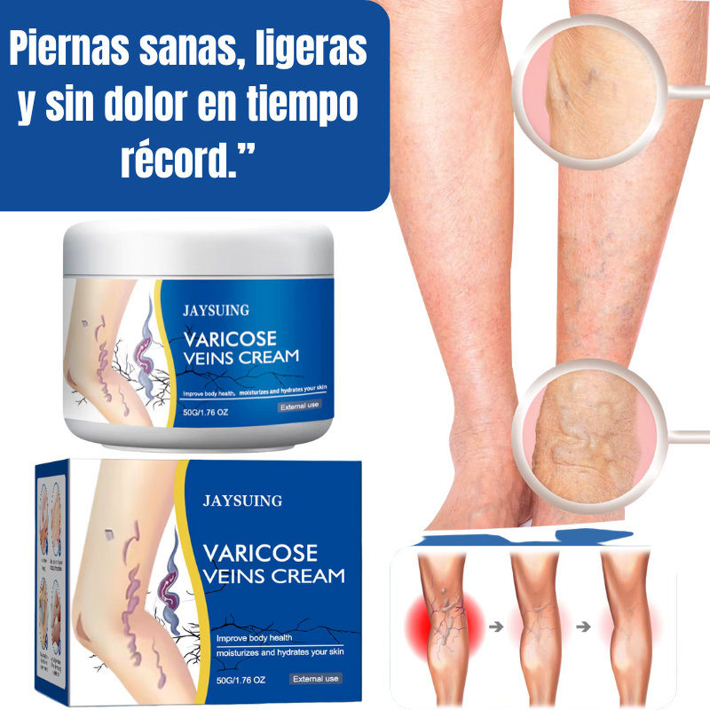 Crema Varicelax – Elimina las Várices y el Dolor en Solo 2 Semanas