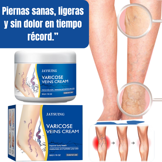 Crema Varicelax – Elimina las Várices y el Dolor en Solo 2 Semanas