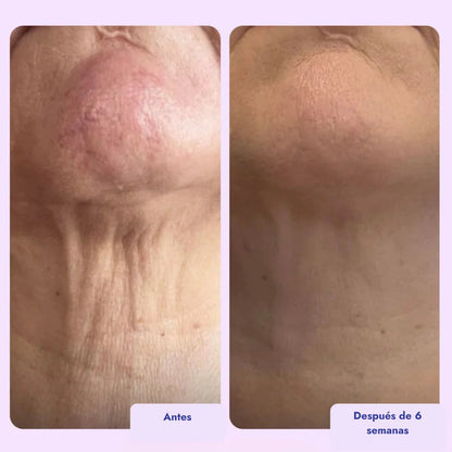 Crema Reafirmante para cuello y escote