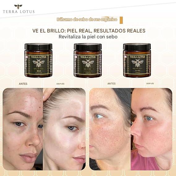 Bálsamo® Dietético Orgánico  Elimina manchas, arrugas y piel opaca