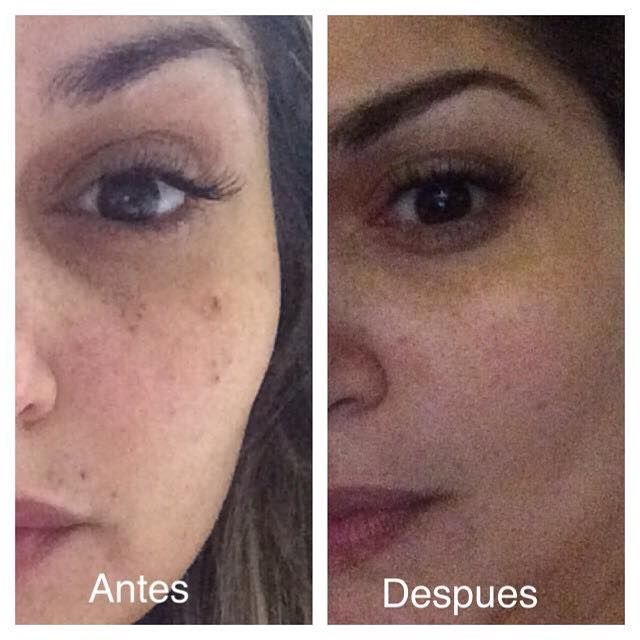 EyeLift Pro – Adiós ojeras y bolsas en 2 minutos