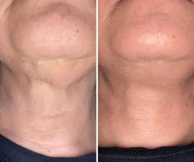 Bálsamo® Dietético Orgánico  Elimina manchas, arrugas y piel opaca